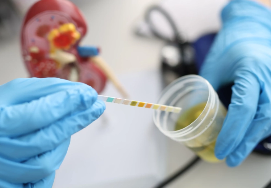 改善腎功能 飲食