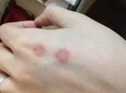 貓癬藥膏推薦