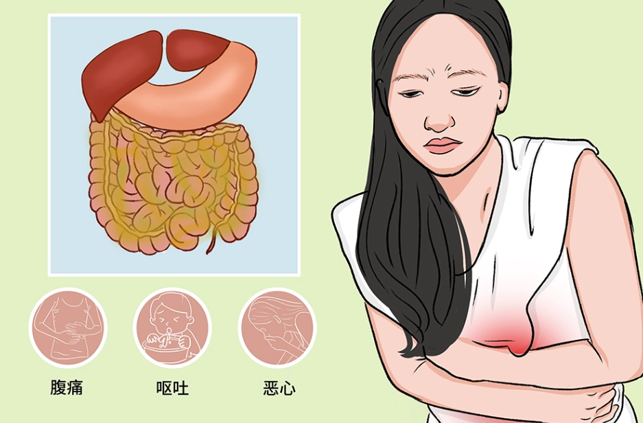 腹膜炎治療