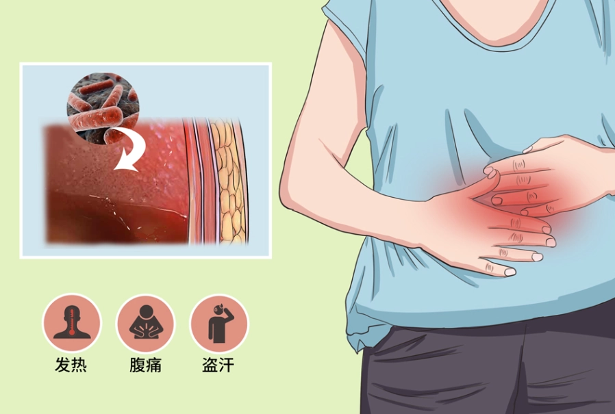 腹膜炎症狀 腹膜炎症狀