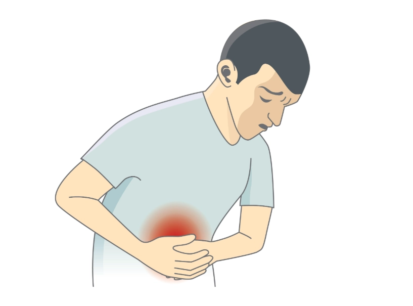 腹膜炎症狀：腹痛一直好不了？這5個徵兆別再拖